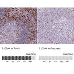 S100A4 Antibody