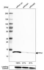 Profilin 1 Antibody