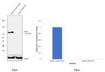 ACE2 Antibody in Western Blot (WB)