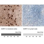 Sortilin Antibody