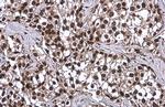 OCT4 Antibody in Immunohistochemistry (Paraffin) (IHC (P))