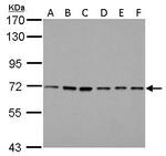 PRMT5 Antibody in Western Blot (WB)