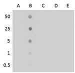 5-Methylcytosine Antibody in Dot Blot (DB)