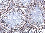 5-Methylcytosine Antibody in Immunohistochemistry (Paraffin) (IHC (P))