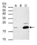 p21 Antibody in Immunoprecipitation (IP)