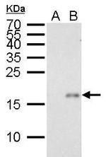 p21 Antibody in Western Blot (WB)