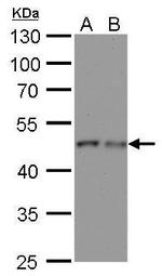 gamma Tubulin Antibody in Western Blot (WB)