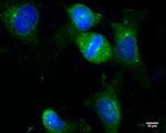 gamma Tubulin Antibody in Immunocytochemistry (ICC/IF)