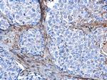 Vimentin Antibody in Immunohistochemistry (Paraffin) (IHC (P))