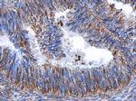 Vimentin Antibody in Immunohistochemistry (Paraffin) (IHC (P))