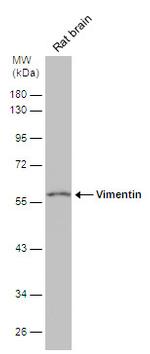 Vimentin Antibody in Western Blot (WB)