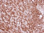 Vimentin Antibody in Immunohistochemistry (Paraffin) (IHC (P))