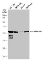 Vimentin Antibody in Western Blot (WB)