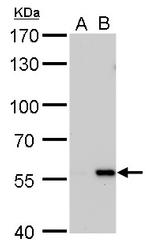 Carbonic Anhydrase IX Antibody in Western Blot (WB)