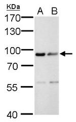 Calnexin Antibody in Western Blot (WB)