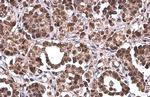 PRMT1 Antibody in Immunohistochemistry (Paraffin) (IHC (P))