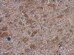 mTOR Antibody in Immunohistochemistry (Paraffin) (IHC (P))