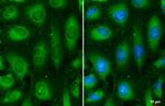 MEK2 Antibody in Immunocytochemistry (ICC/IF)