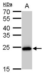 SOD2 Antibody in Western Blot (WB)