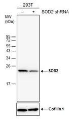 SOD2 Antibody in Western Blot (WB)