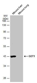 GOT1 Antibody in Western Blot (WB)