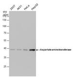 GOT1 Antibody in Western Blot (WB)