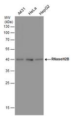 RNaseH2B Antibody in Western Blot (WB)