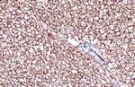 UCP1 Antibody in Immunohistochemistry (Paraffin) (IHC (P))