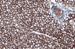 UCP1 Antibody in Immunohistochemistry (Paraffin) (IHC (P))