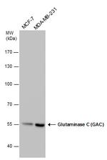 Glutaminase C (GAC) Antibody in Western Blot (WB)