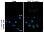 LC3B Antibody in Immunocytochemistry (ICC/IF)