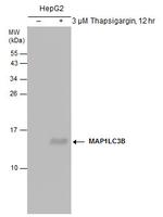 LC3B Antibody in Western Blot (WB)