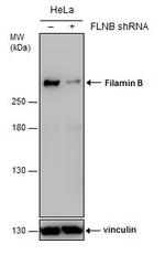 Filamin B Antibody in Western Blot (WB)