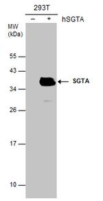 SGTA Antibody in Western Blot (WB)