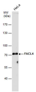 ACSL4 Antibody in Western Blot (WB)