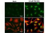 H2AK5ac Antibody in Immunocytochemistry (ICC/IF)