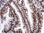 BRG1 Antibody in Immunohistochemistry (Paraffin) (IHC (P))