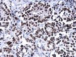 BRG1 Antibody in Immunohistochemistry (Paraffin) (IHC (P))