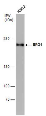 BRG1 Antibody in Western Blot (WB)