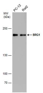 BRG1 Antibody in Western Blot (WB)