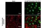 H2BK20ac Antibody in Immunocytochemistry (ICC/IF)