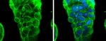 Glypican 3 Antibody in Immunocytochemistry (ICC/IF)