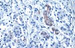 Glypican 3 Antibody in Immunohistochemistry (Paraffin) (IHC (P))