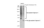 Glypican 3 Antibody in Western Blot (WB)