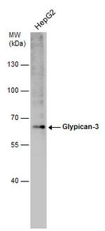 Glypican 3 Antibody in Western Blot (WB)