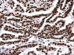 H4K8ac Antibody in Immunohistochemistry (Paraffin) (IHC (P))