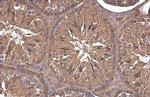 Paxillin Antibody in Immunohistochemistry (Paraffin) (IHC (P))