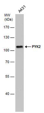 PYK2 Antibody in Western Blot (WB)