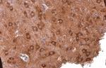 PYK2 Antibody in Immunohistochemistry (Paraffin) (IHC (P))