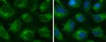 EEA1 Antibody in Immunocytochemistry (ICC/IF)